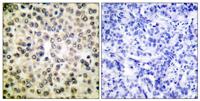 NFκB-p65 Polyclonal Antibody
