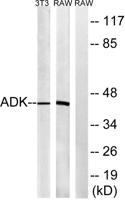 ADK Polyclonal Antibody