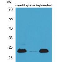 ADM Polyclonal Antibody