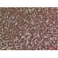ADM Polyclonal Antibody