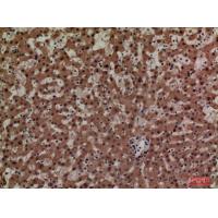 ADM Polyclonal Antibody