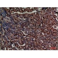 ADM Polyclonal Antibody