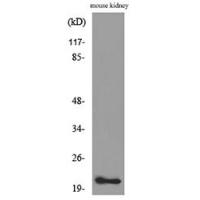 ADM Polyclonal Antibody