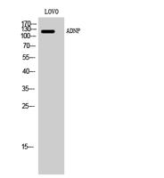 ADNP Polyclonal Antibody