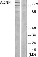 ADNP Polyclonal Antibody