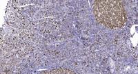 ADNP Polyclonal Antibody