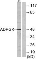 ADP-GK Polyclonal Antibody