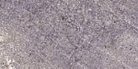 ADP-GK Polyclonal Antibody