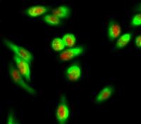 AF-10 Polyclonal Antibody