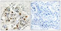 AF-4 Polyclonal Antibody