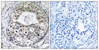 Ribosomal Protein S13 Polyclonal Antibody