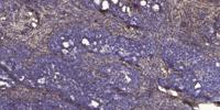 Ribosomal Protein S18 Polyclonal Antibody