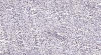 Ribosomal Protein S19 Polyclonal Antibody