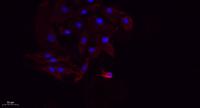 NGF Polyclonal Antibody
