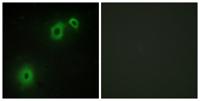 NGFR p75 Polyclonal Antibody