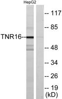 NGFR p75 Polyclonal Antibody