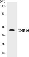 NGFR p75 Polyclonal Antibody