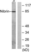 Nibrin Polyclonal Antibody