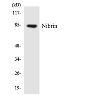 Nibrin Polyclonal Antibody