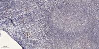 Nibrin Polyclonal Antibody