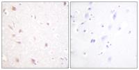 NIFK Polyclonal Antibody