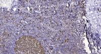 NIPBL Polyclonal Antibody