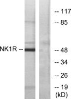 NK-1R Polyclonal Antibody