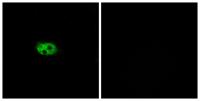 NK-3R Polyclonal Antibody