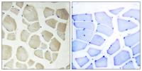 NKIAMRE Polyclonal Antibody