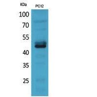 NKp44 Polyclonal Antibody