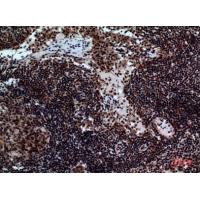 NKp44 Polyclonal Antibody