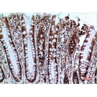 NKp44 Polyclonal Antibody