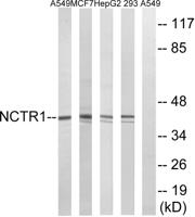 NKp46 Polyclonal Antibody
