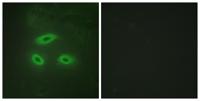 NK-TR Polyclonal Antibody