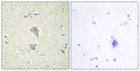 NK-TR Polyclonal Antibody