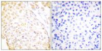 Nkx-3.1 Polyclonal Antibody