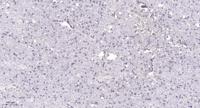 NLE1 Polyclonal Antibody