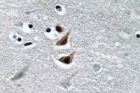 NM23-H1 Polyclonal Antibody