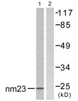NM23-H2 Polyclonal Antibody