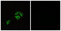 NMBR Polyclonal Antibody