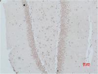NMBR Polyclonal Antibody