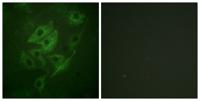 NMDAε1/2 Polyclonal Antibody