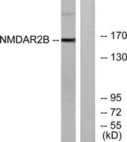 NMDAε2 Polyclonal Antibody