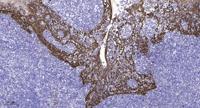 NMDAε2 Polyclonal Antibody