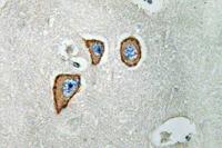 NMDAε3 Polyclonal Antibody