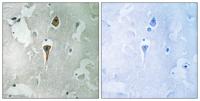 NMDAζ1 Polyclonal Antibody