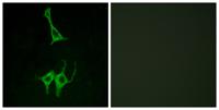 NMUR1 Polyclonal Antibody