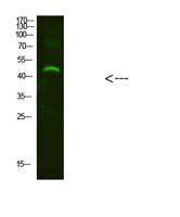NMUR2 Polyclonal Antibody