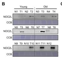 NOC2L Polyclonal Antibody