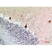 Nodal Polyclonal Antibody